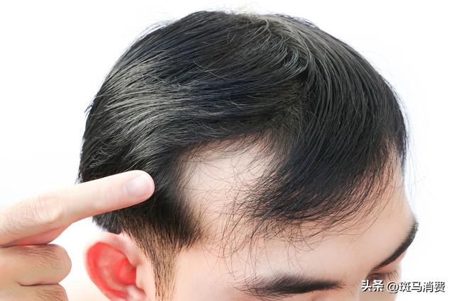 雍禾医疗,种得青丝难解愁