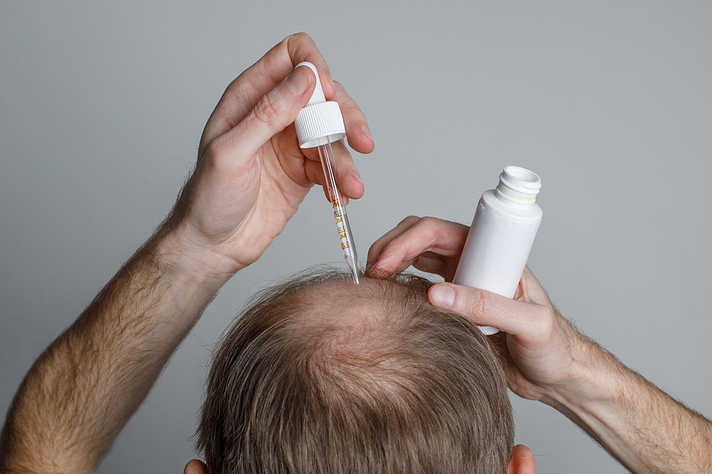 三生制药分拆“防脱神药”蔓迪赴港上市，IPO前分红7.7亿元